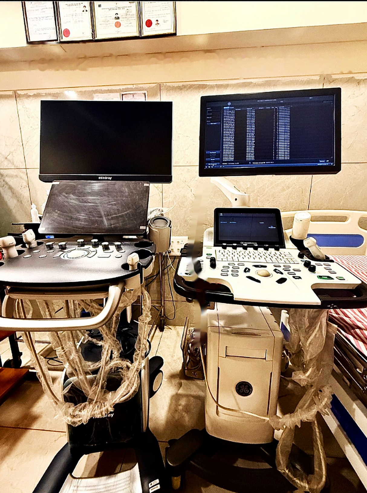 2D echo diagnostic department